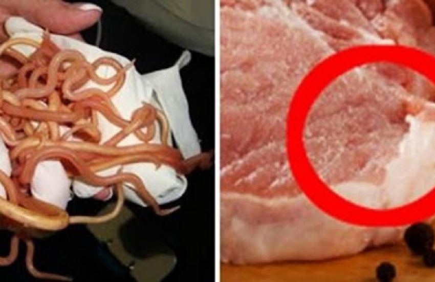 Após comer carne de porco crua, homem tem 700 tênias em seu cérebro 