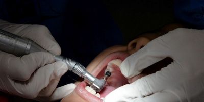 Projeto prevê saúde bucal como requisito para pagamento do Auxílio Brasil
