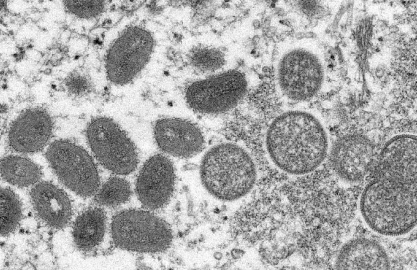 RS tem dois casos confirmados e seis suspeitos de varíola dos macacos 