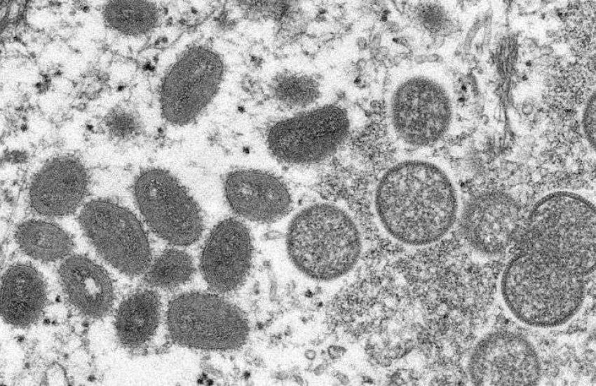 Distrito Federal tem primeiro caso de varíola dos macacos 