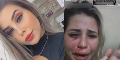 Influenciadora denuncia agressão de namorado e pede socorro no Instagram