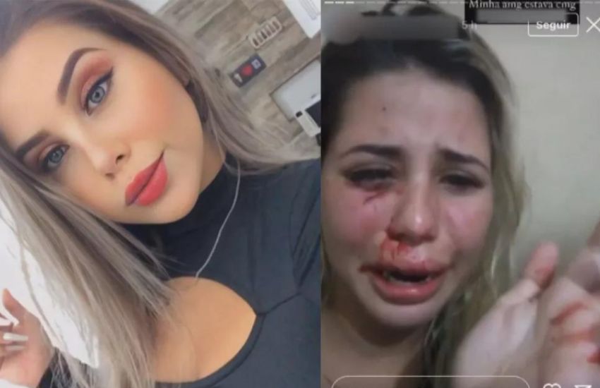 Influenciadora denuncia agressão de namorado e pede socorro no Instagram 