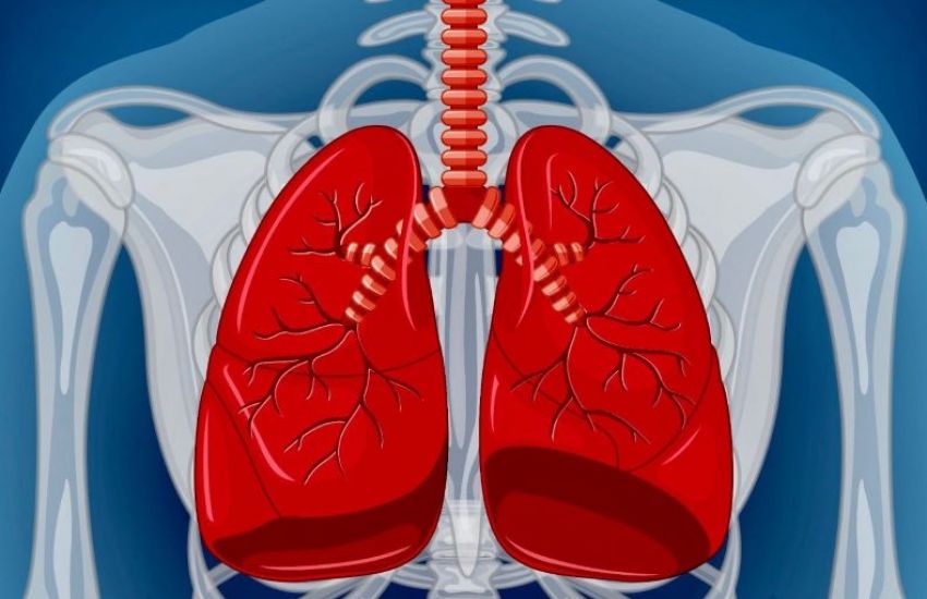 Brasil faz 1º autotransplante de pulmão em paciente com câncer metastático 